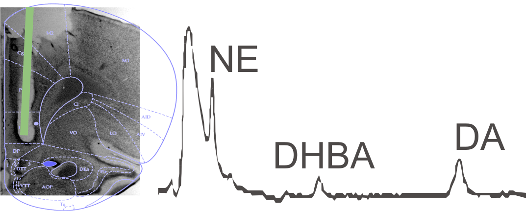 Dialysis