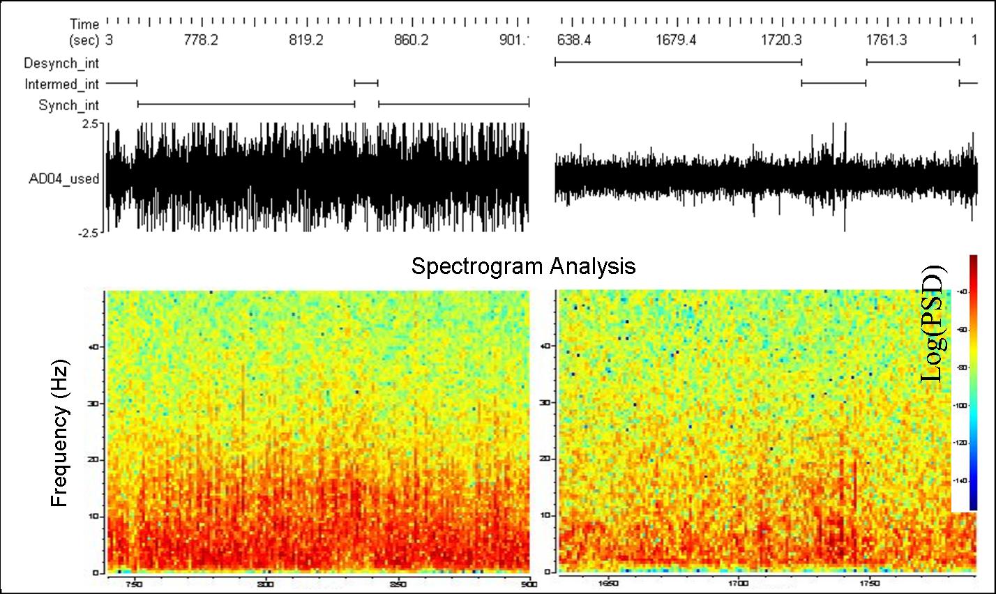 eeg_analysis.jpg