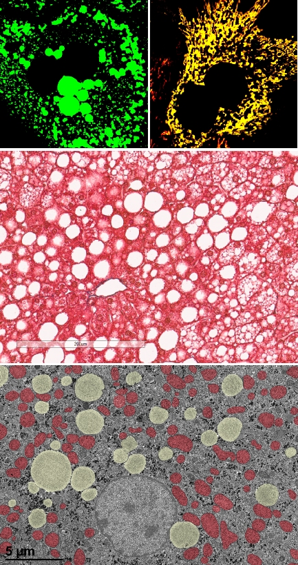 picture describes the research on how lipid accumulation occurs in pathological conditions