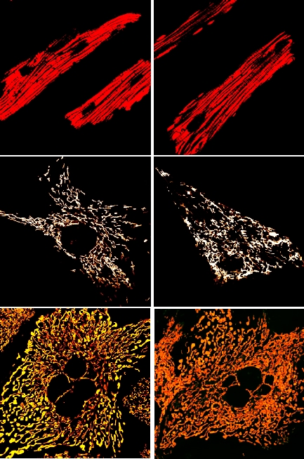 picture describes the research using mitochondrial Mg2+ channel knock out cells