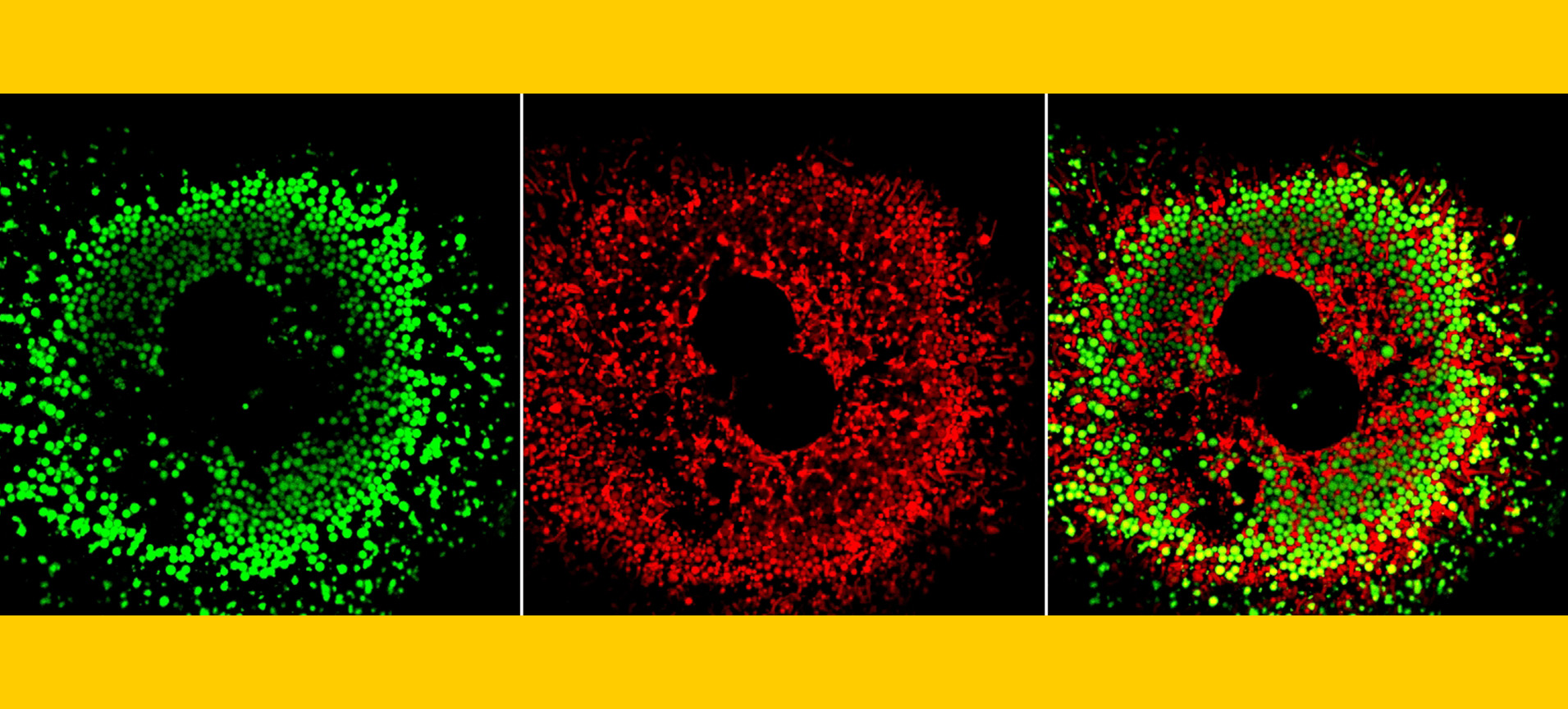 Visualization of lipids in hepatocytes