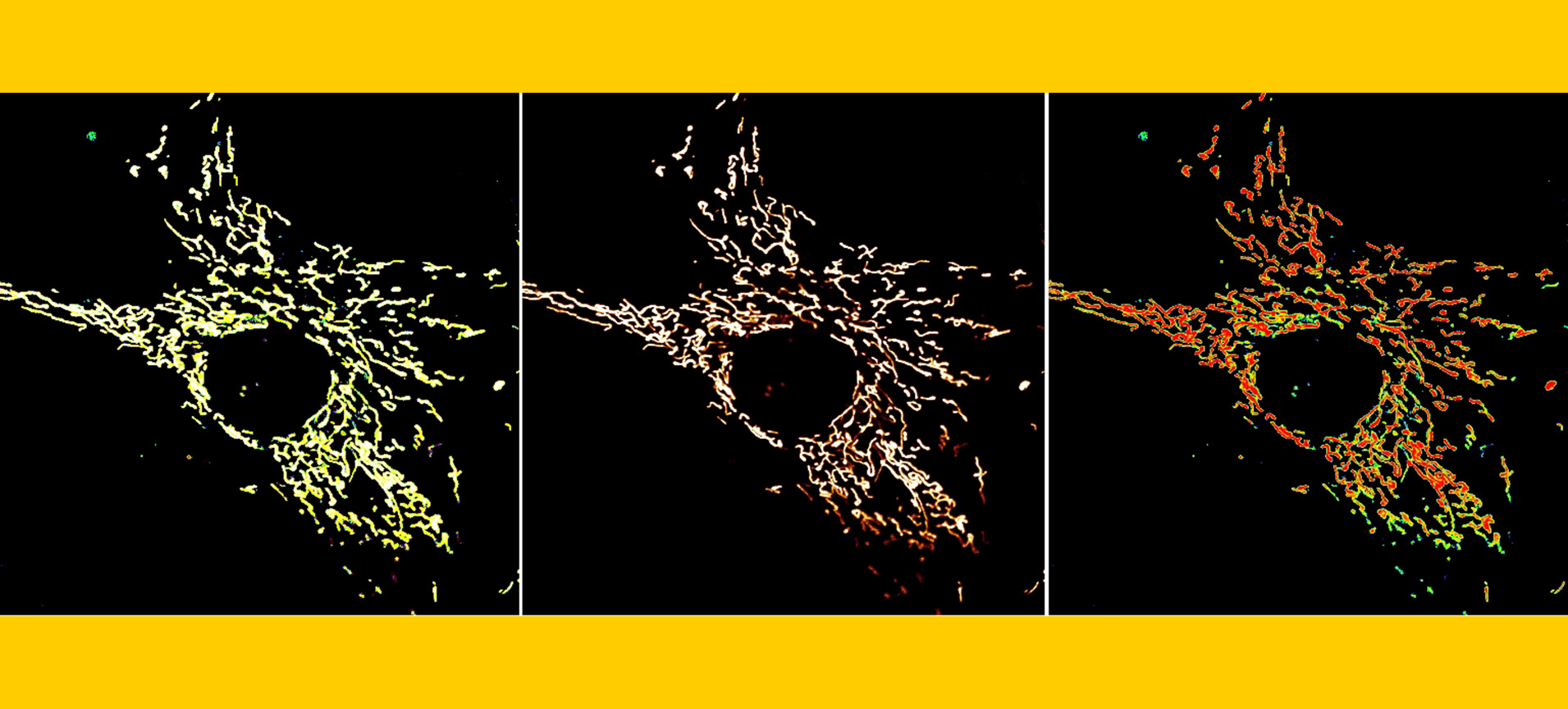 Visualization of mitochondria in cervical carcinoma cells