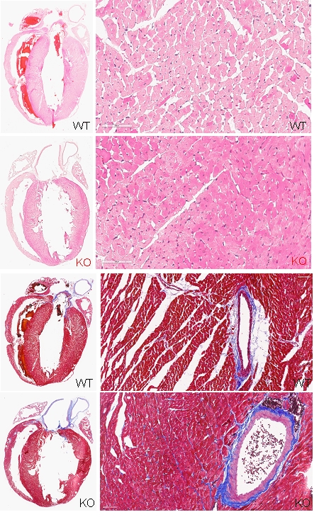 picture describes the research on McArdle's disease