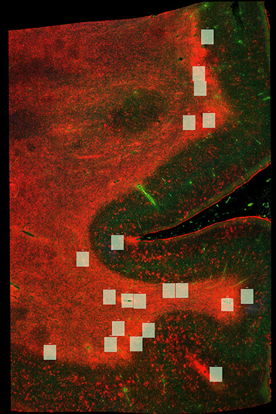 imagery from a microscope that relates to HIV and Glymphatic Dysfunction